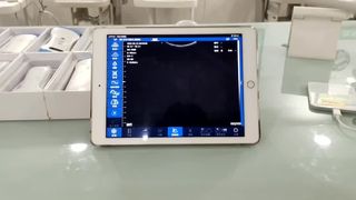 Draadloze echografiesonde met dubbele kop voor OB-GYN-diagnostiek