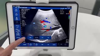 Draadloze handheld echografie, alles-in-oplossing