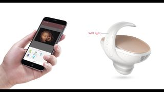 Marvoto Foetuscamera M1- 3D Handheld-echografie