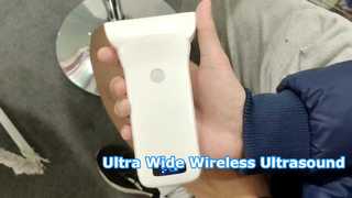 85mm Ultra Wide Wireless Ultrasound for Vascular Access
