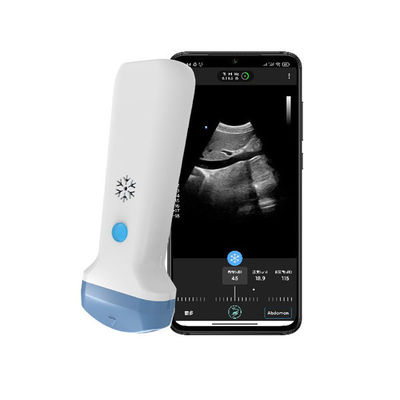 kopen De digitale Draadloze Convexe Sonde van Wifi met 128 elementendiepte 378mm online manufacture