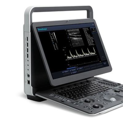 kopen 15.6“ LCD Sonoscape E2 Ultrasone klankmachine met 2 Jaargarantie online manufacture