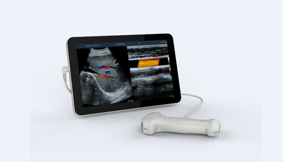 kopen 5V de dubbele Hoofd Draagbare Handbediende Hoge Frequentie van de Ultrasone klankscanner online manufacture