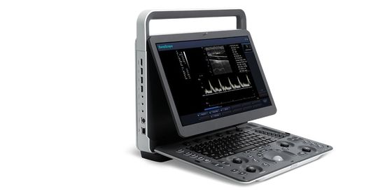 kopen van de de Ultrasone klankmachine van de 15,6 duim LEIDENE de Draagbare Kleurendoppler van SonoScape Ultrasone klank van BW online manufacture