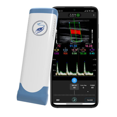 kopen 12MHz draadloze draagbare echografiescanner voor iPhone en iPad | Elektronische lineaire array kleurendopplersonde online manufacture
