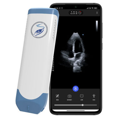 kopen Draadloze Phased Array Handheld Ultrasound Scanner 5MHz Pocket Cardiale Echografie voor POCUS Echocardiografie online manufacture