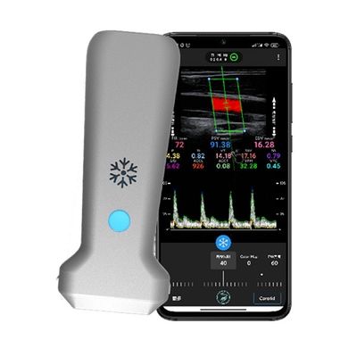 kopen WiFi draadloze lineaire handheld kleurendoppler-echografiescanner | 30 FPS Realtime beeldvorming | Draagbare medische echografiesonde online manufacture