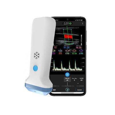 kopen Draadloze lineaire handheld echografiescanner | 4/8,3/12 MHz draagbare kleurendoppler-echografiesonde online manufacture