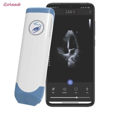 kopen 3.6MHz draagbare Draadloze Gefaseerde Ultrasone klanksonde - serieomvormer online manufacture