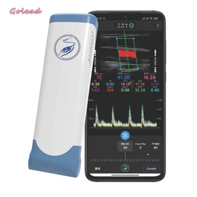 kopen Elektronische Lineaire Draadloze Draagbare de Ultrasone klankscanner 12MHz van Seriewifi online manufacture