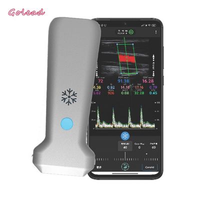 kopen 126mm de Convexe Scanner van de Sondeultrasone klank voor Vasculaire MSK-Zenuw online manufacture