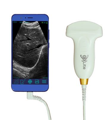 kopen Elektronische Convexe Handbediende de Ultrasone klankscanner 3.5MHz van Doppler van de Seriekleur online manufacture