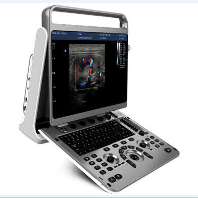 kopen De ergonomische Machine Chison EBit 30 van de Ontwerp Draagbare Ultrasone klank online manufacture