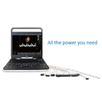 kopen De Ultrasone klank Chison EBit 60 van 128 Elementenwifi voor Cardiovasculair online manufacture