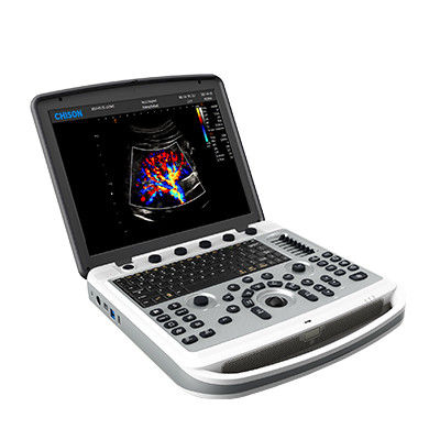 kopen 120° draaibare Chison SonoBook 6 Draagbare Laptop Ultrasone klankmachine online manufacture