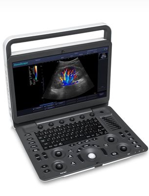 kopen 15.6inch de Ultrasone klank van BW van de de LEIDENE Ultrasone klankmachine van Sonoscape E1 Exp online manufacture