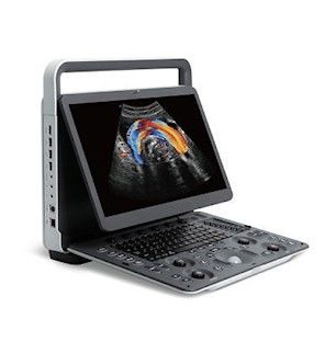 kopen Panoramische PRO Draagbare de Ultrasone klankmachine van Weergavesonoscape E2 online manufacture