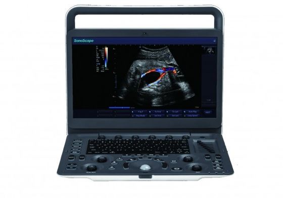 kopen 7 Draagbare de Ultrasone klankmachine van SonoScape E3 van weergaveniveaus met 15,6 Duimmonitor online manufacture