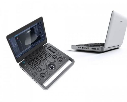 kopen Slimme Gezichts500gb Laptop de Ultrasone klankmachine van SonoScape met 15,6“ LCD online manufacture