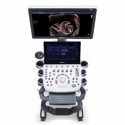 kopen de Ultrasone klankmachine van 4D Elastography SonoScape voor OB en Gynaecologie online manufacture