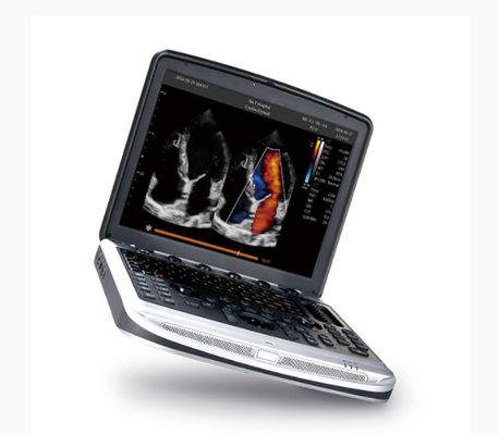 kopen FDA Goedgekeurde Laptop Ultrasone klankmachine Chison SonoBook 8 voor Echocardiografie online manufacture