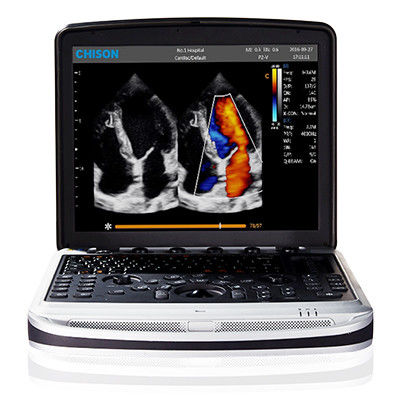 kopen Gemakkelijk om 4D Chison SonoBook 9 te dragen Laptop Ultrasone klankmachine online manufacture