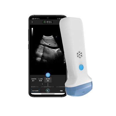 kopen HDMI-uitgang Draadloze Convexe Handheld Ultrasound Scanner 3.6MHz Draagbare Kleur Doppler POCUS Ultrasound online manufacture