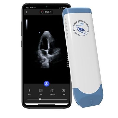 kopen Diepte 18.9cm Handbediende Ultrasone klankscanner voor Iphone 3.6MHz online manufacture