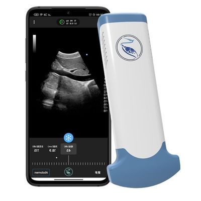 kopen Noodsituatiegeneeskunde mpeg-4 Handbediende Ultrasone klankscanner voor Klinisch Kenmerkend Gebruik online manufacture