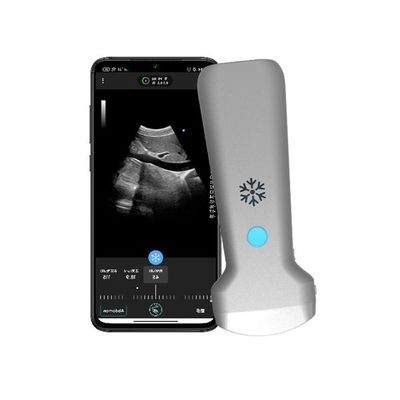 kopen ISO13485 draadloze convexe draagbare echografiescanner | Draagbare kleurendoppler-echografiesonde online manufacture