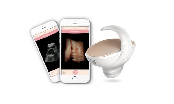kopen CE-goedgekeurde 3D/4D draagbare foetale echografie
Draagbare zwangerschapsbeeldopname-oplossing met 60° breedhoekige convexe sonde online manufacture