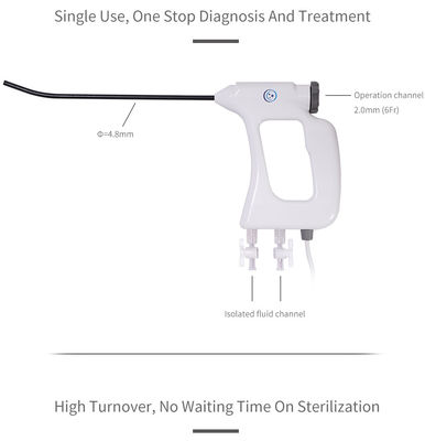 kopen FDA CE ISO13485 wegwerp elektronische hysteroscoop 4,8 mm voor gynaecologische endoscopische procedures online manufacture