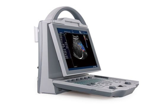 kopen Draagbare kleurendoppler-echografiemachine voor zwangerschap | Instapmodel laptop-echografiesysteem DCU12 online manufacture