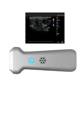 kopen 8.3MHz draadloze Diepte 12.6cm van de Ultrasone klanksonde Lineaire Sondeultrasone klank online manufacture