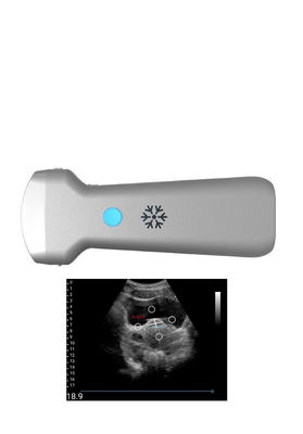 kopen Sonde van de Ultrasonication de Convexe Draadloze Ultrasone klank voor Gynaecologie online manufacture