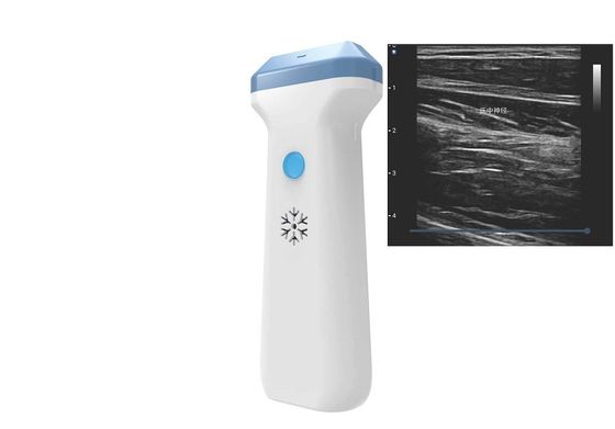 kopen DICOM-BMP PNG JPEG 128 de Ultrasone klanksonde 80 To180dB van Elementenwifi online manufacture