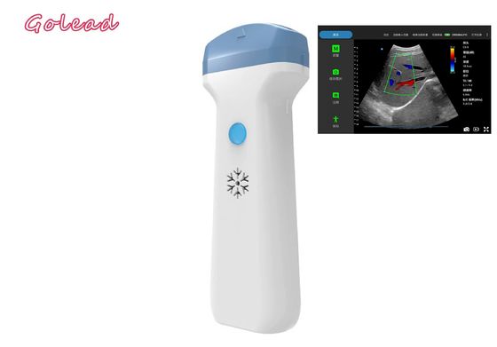 kopen Draadloze de Ultrasone klanksonde van anesthesieipad voor POCUS-Examens Primaire Zorg online manufacture