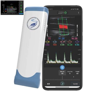 kopen Van de de Ultrasone klankomvormer van Ipad van 256 Aftastenlijnen Draadloze de Ultrasone klanksonde voor PICC online manufacture