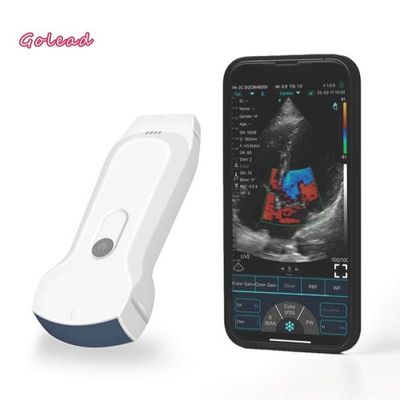 kopen 3 in 1 Draadloze Ultrasone klanksonde met 8 Aanpassingstgc WiFi Verbinding online manufacture