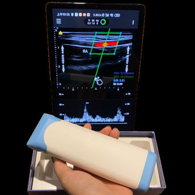 kopen Hoogwaardige elektronische lineaire matrix PICC handheld ultrasound scanner online manufacture