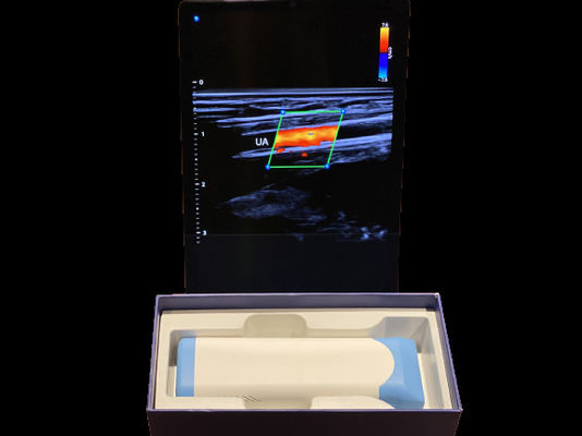 kopen Geavanceerde handheld ultrasound scanner 0.2kg met 3000mAh batterij voor medische doeleinden online manufacture