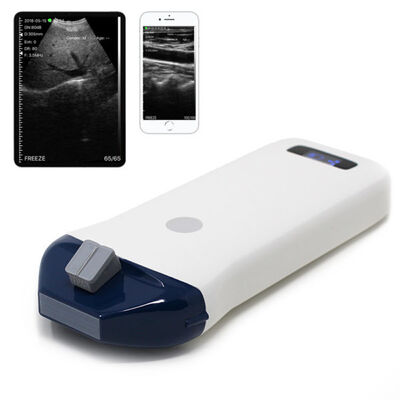kopen Draadloos handheld echografiesysteem voor naaldgeleiding en interventionele procedures online manufacture