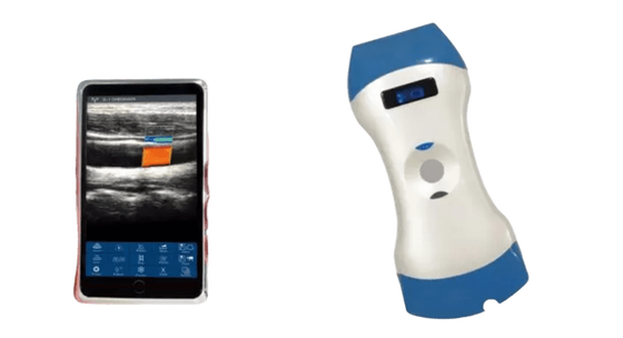 kopen Draadloze draagbare ultrasone sonde met 128 elementen en dubbele kop – één sonde voor diepe beeldvorming, oppervlakkige beeldvorming en point-of-care-diagnose online manufacture