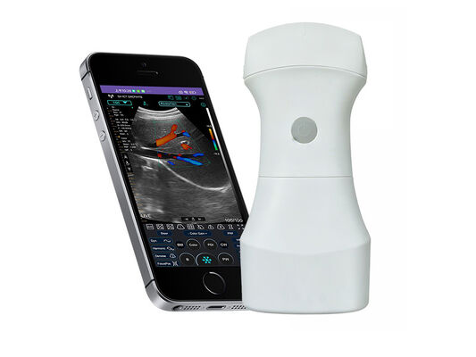 kopen Draadloze Pocket Convexe Ultrasound Scanner met vervangbare batterij voor draagbare klinische beeldvorming online manufacture