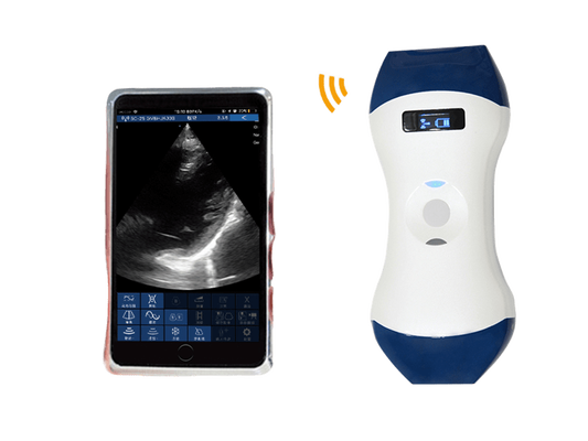 kopen FDA CE ISO13485 Palmformaat draadloze handheld echografiesonde met Phased Array en lineaire dubbele kop voor POCUS online manufacture