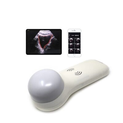 kopen Draadloze 4D draagbare blaasscanner voor point-of-care urinevolumemeting online manufacture