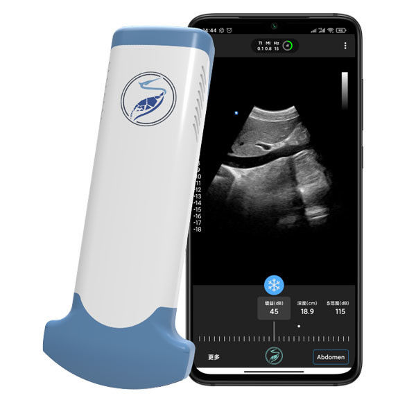 Ce Duidelijke van de Ultrasone klankscanners JPEG van 3.6MHz Draagbare Wifi BMP PNG mpeg-4