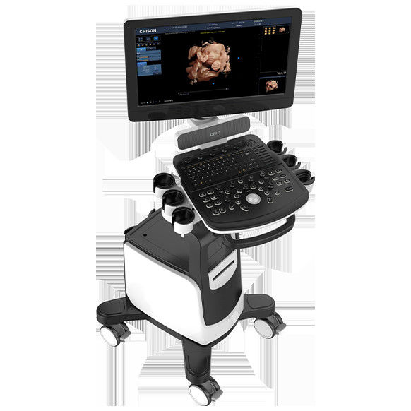 Van 19 Duim LEIDEN de Ultrasone klankmachine Chison QBit 7 Kleurendoppler