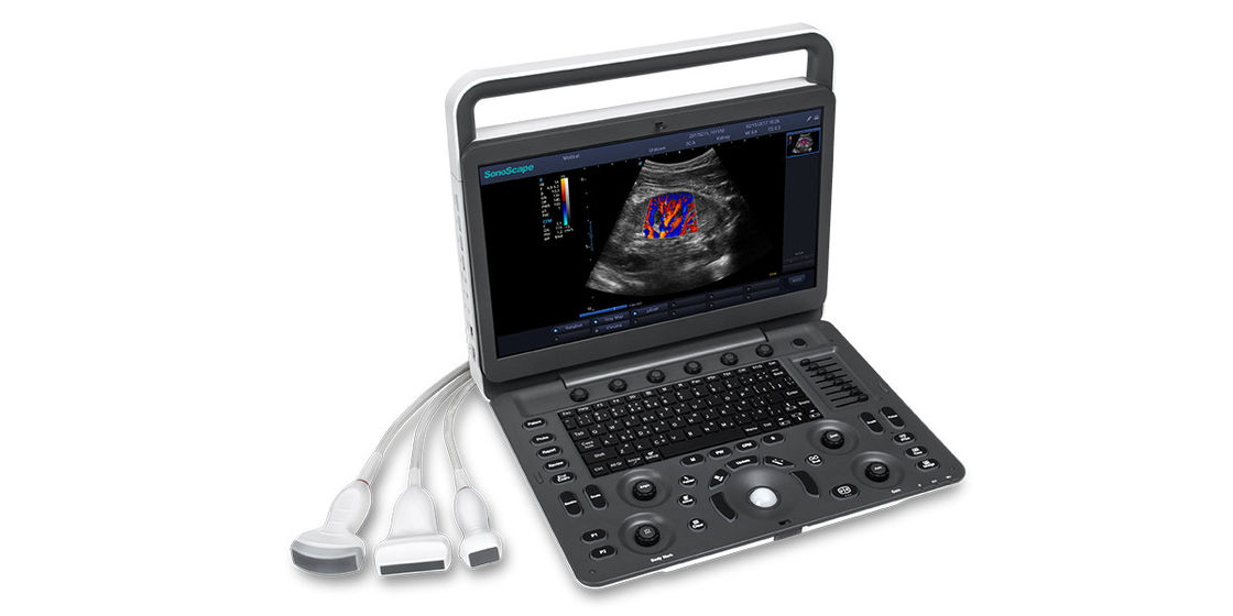 7 Draagbare de Ultrasone klankmachine van SonoScape E3 van weergaveniveaus met 15,6 Duimmonitor