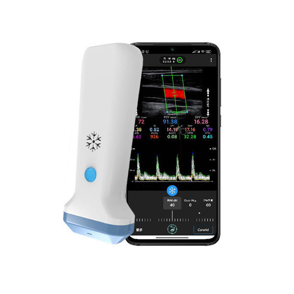 Draadloze lineaire handheld echografiescanner | 4/8,3/12 MHz draagbare kleurendoppler-echografiesonde